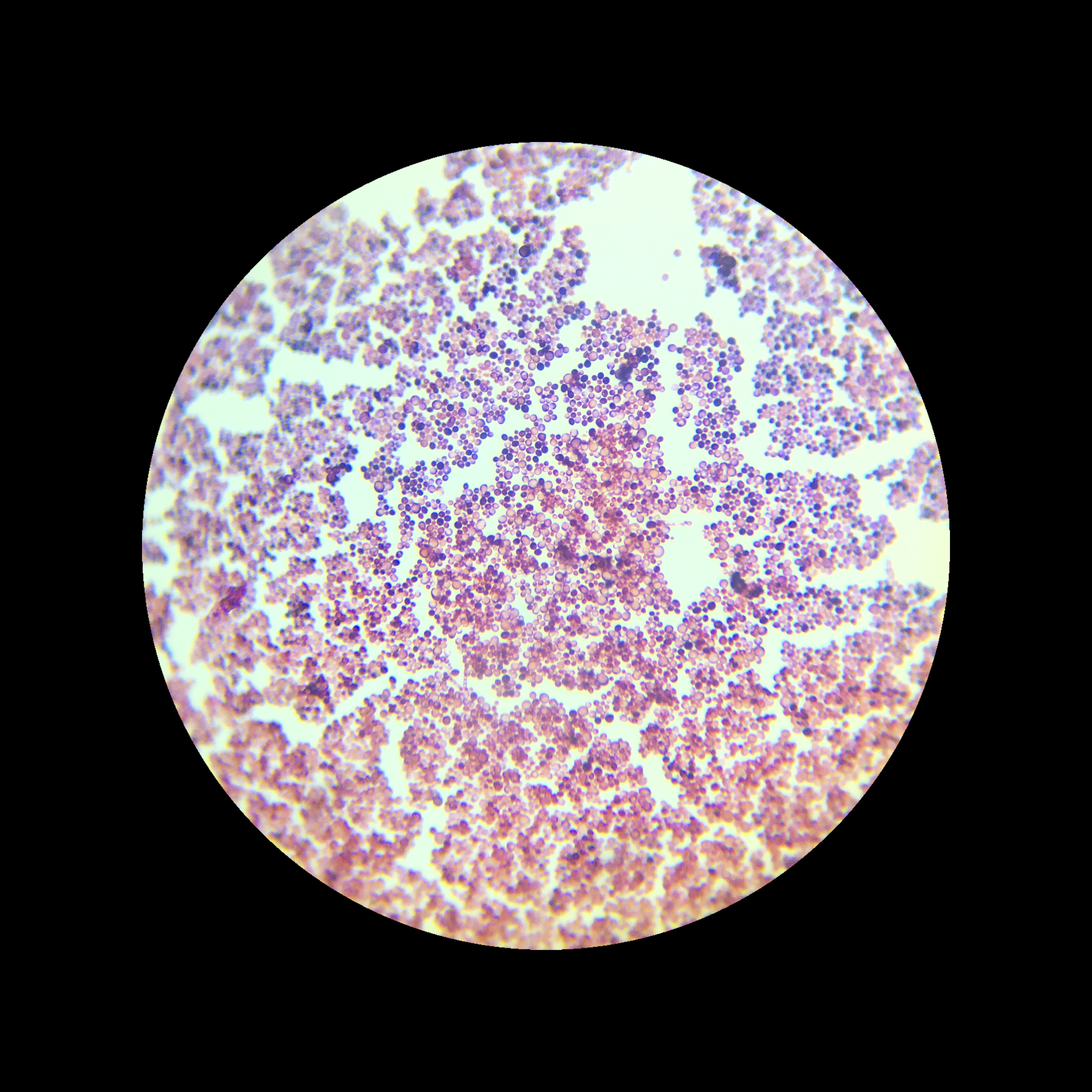 Candida albicans