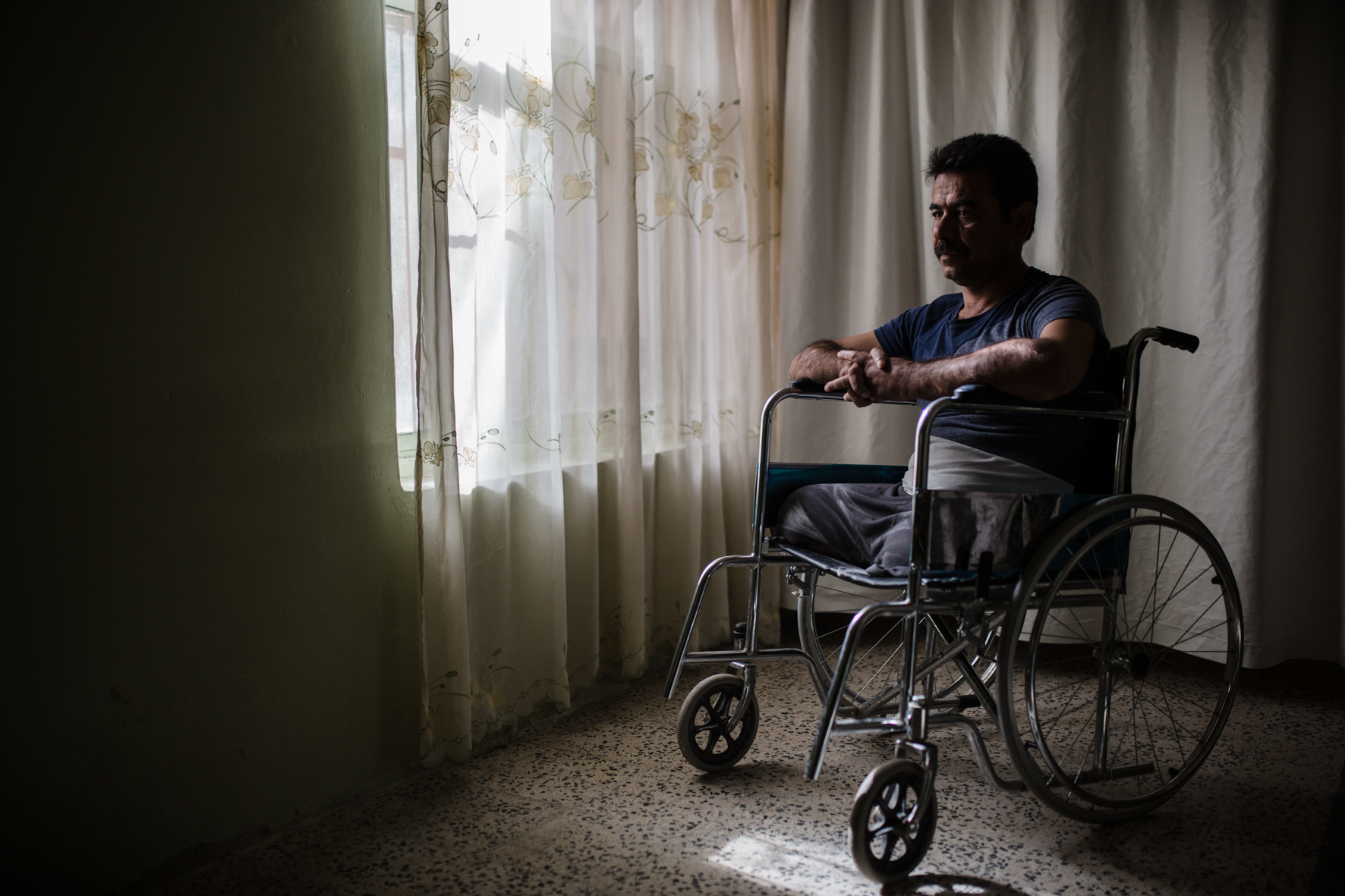 "I was driving. Suddenly I was up in the air and noticed that I don't have legs anymore."