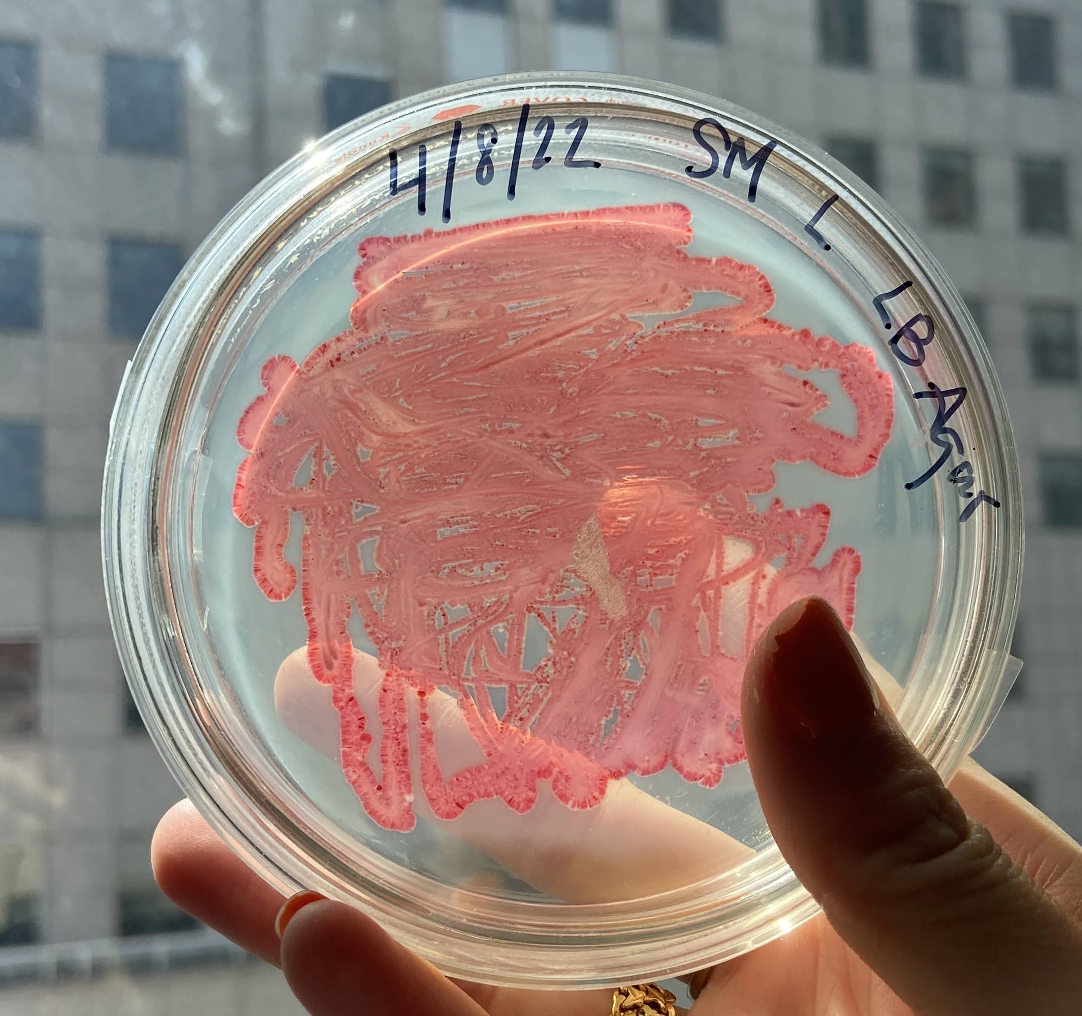 First Signs of Pigment