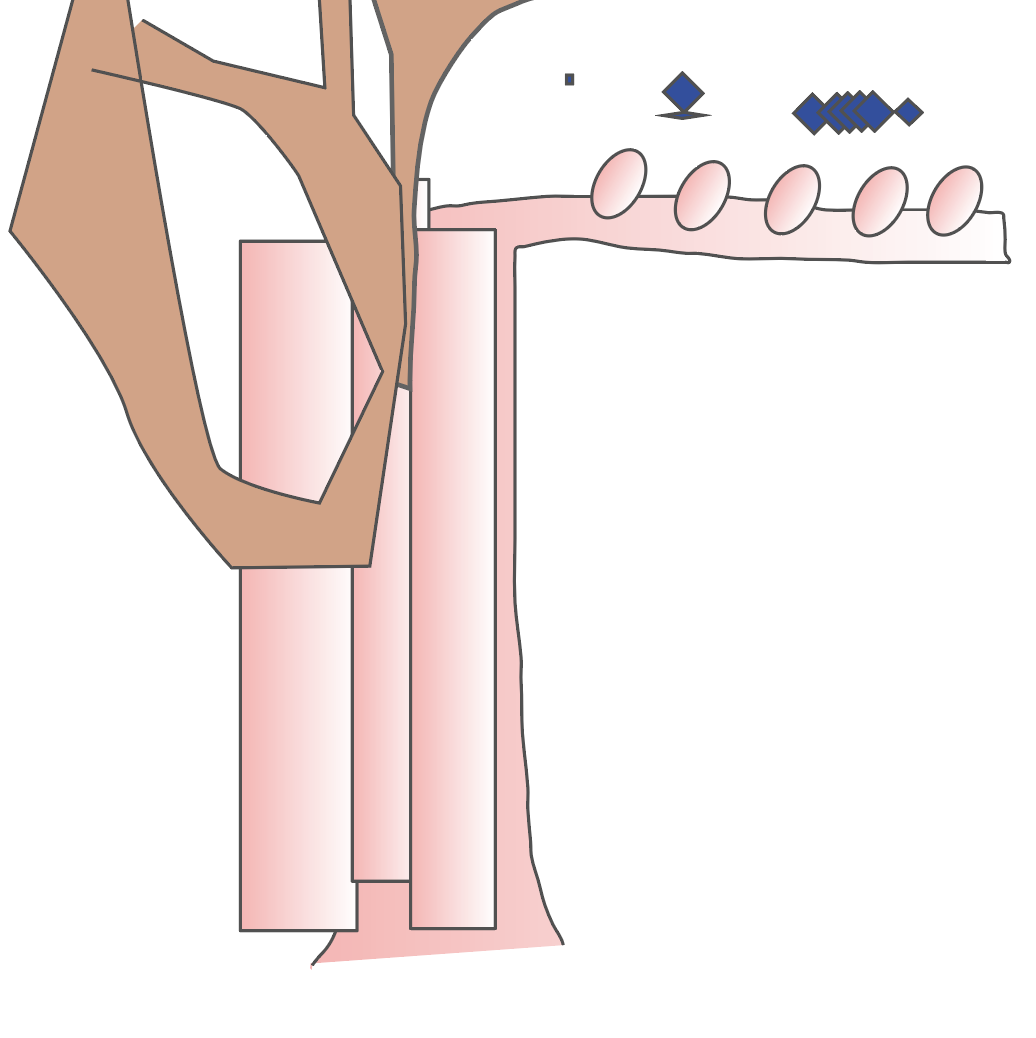 「 a Normal Tree 」