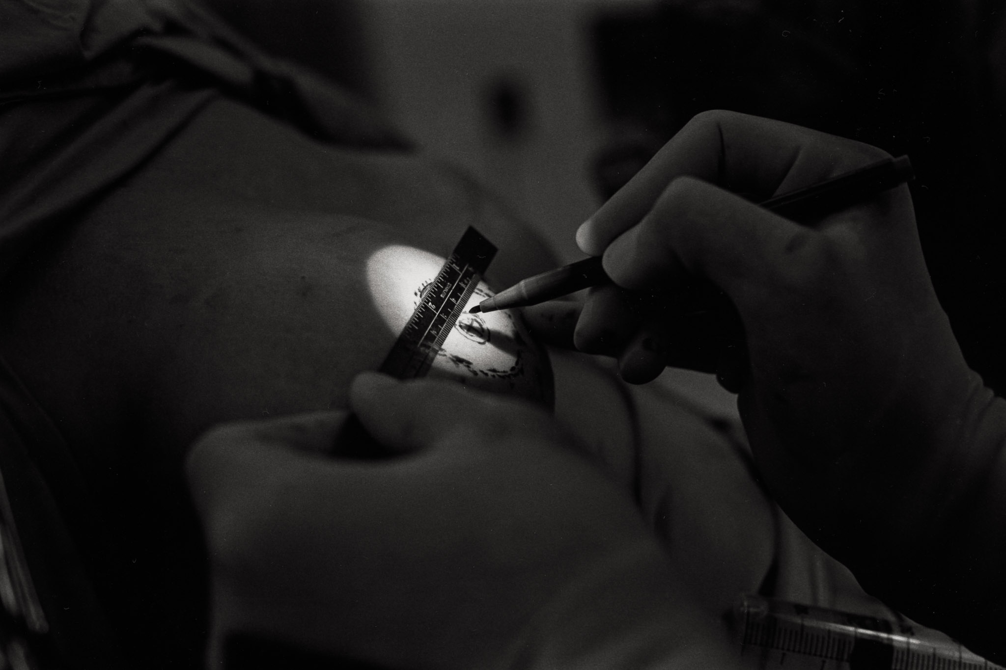 As she nears the end of reconstruction, Diane brings her surgeon an image of how she would like her finished breasts to appear. He explains what he can and cannot do.