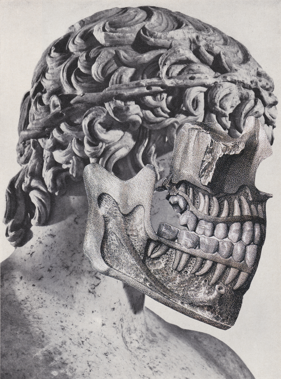 Masks