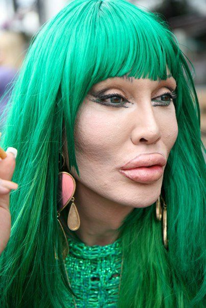 Pete Burns