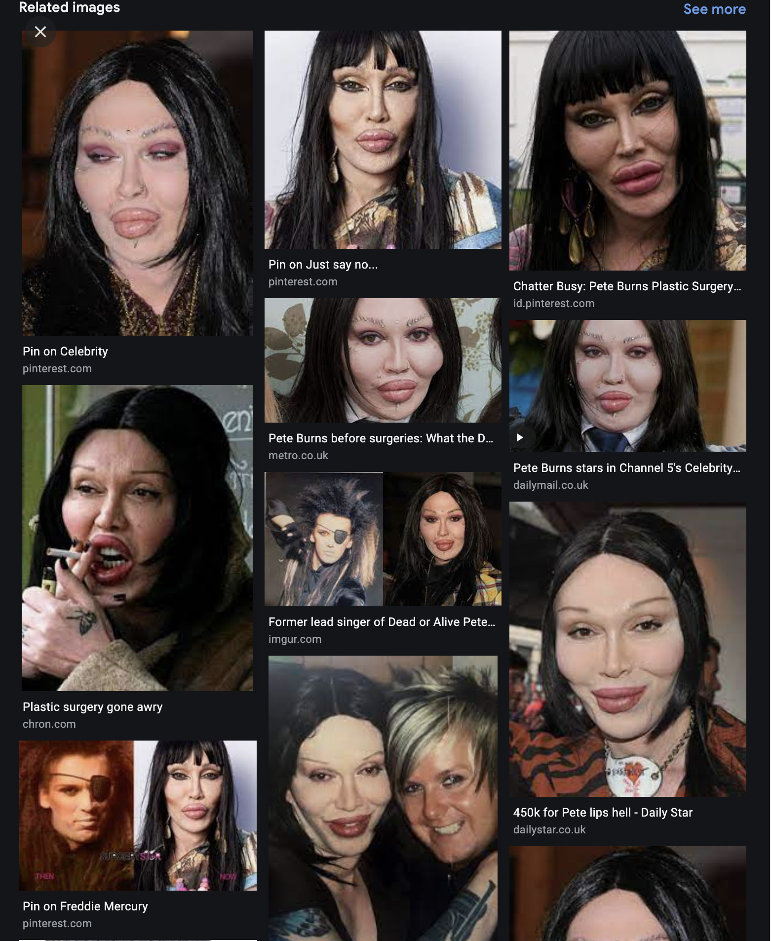 Pete Burns