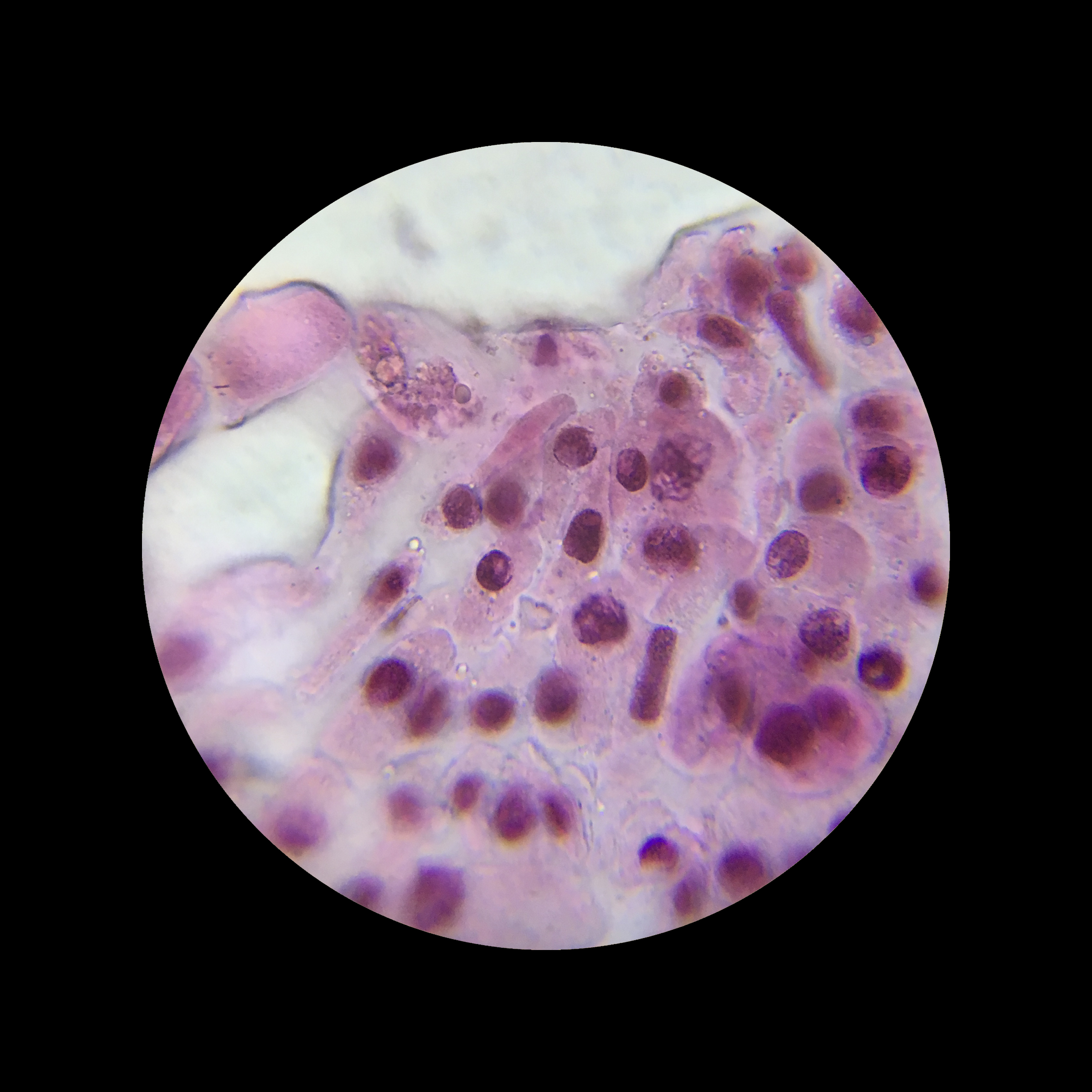 Mitosis