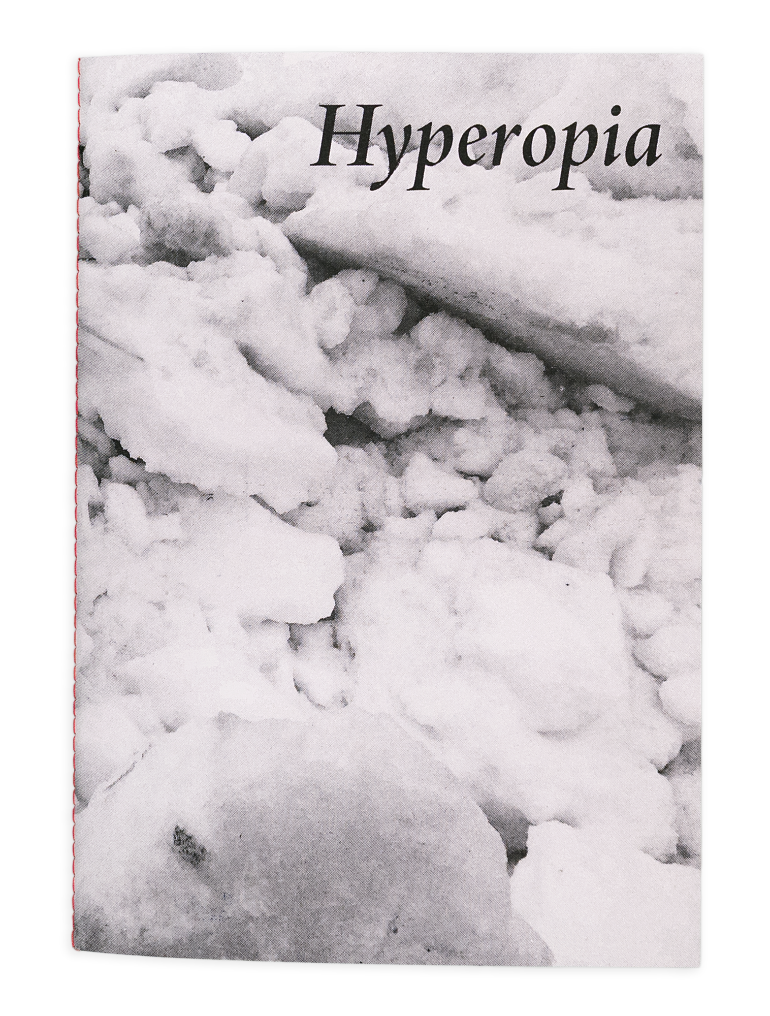 Hyperopia