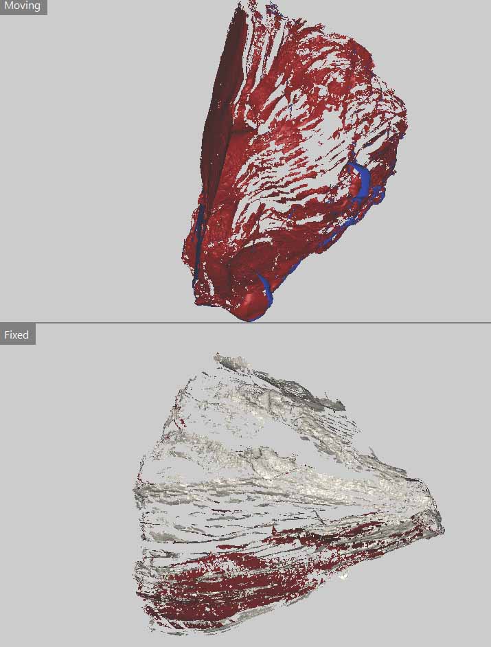 FIGURE 25 Digital output of 3D scans.